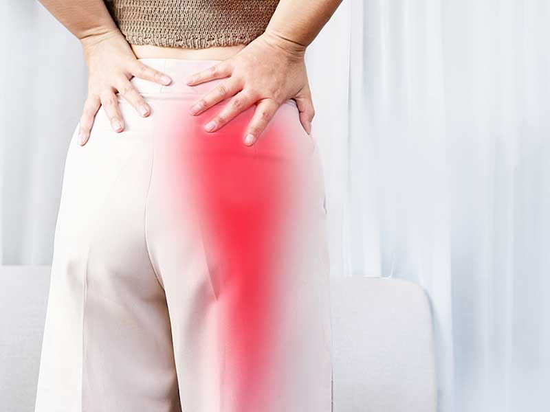 Sciatica,Pain,Concept,With,Woman,Suffering,From,Buttock,Pain,Spreading Frau mit Ischiasschmerzen im unteren Rücken und Oberschenkel – farblich markierter Schmerzverlauf.