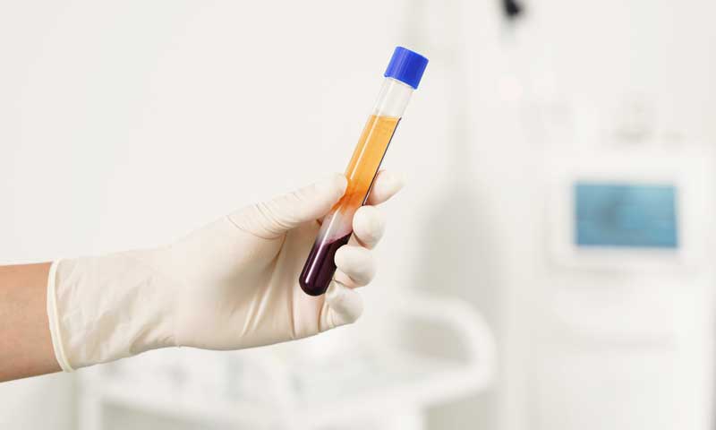 Behandlung mit Eigenbluttherapie